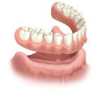 Dentures illustration